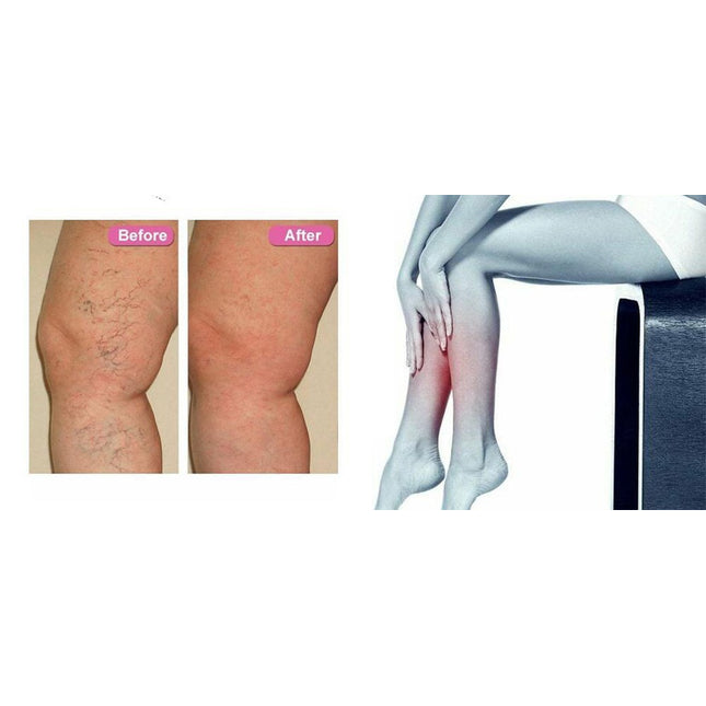 VeinEase Repair Lotion