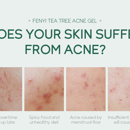 20g Moisturizing Skin Care Products