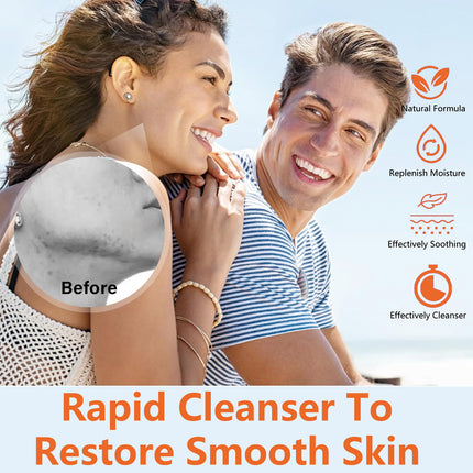 Anti-acne Smallpox Diluting Cream Oil Control Closed Mouth Men And Women