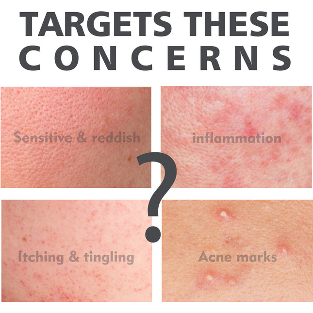 Salicylate Skin Repair Acne Skin Care Water