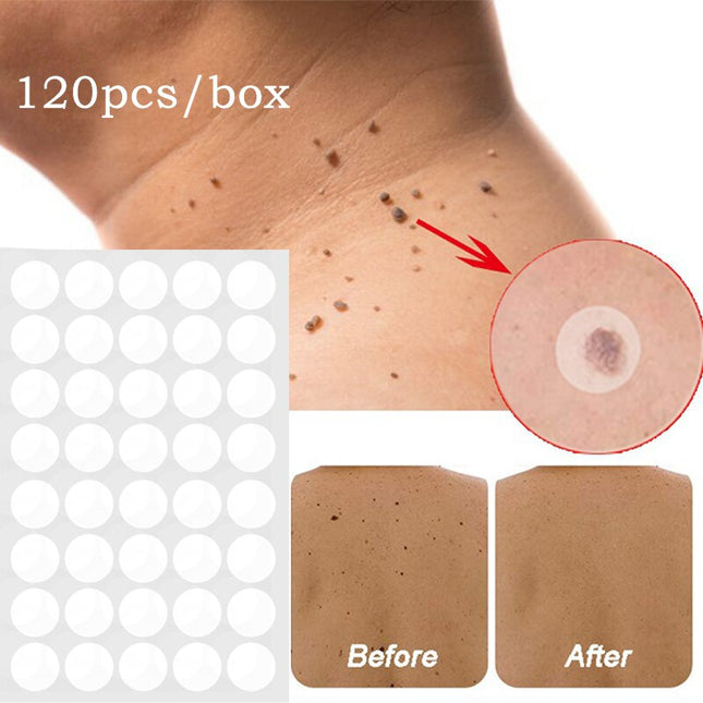 120/360pcs Skin Tags Remover Wart Treatment Instant Removal Acne Corn