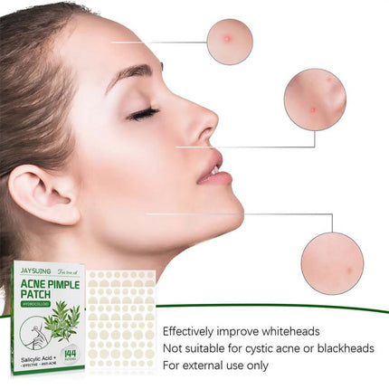 144 Patches Acne Pimple Patch Tea Tree Oil Serum Acne Treatment Pimple