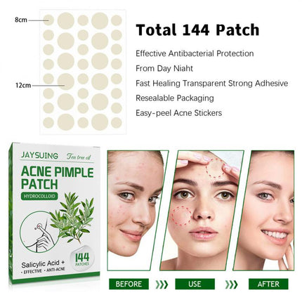 144 Patches Acne Pimple Patch Tea Tree Oil Serum Acne Treatment Pimple