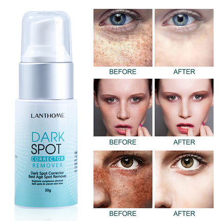 Dark Spot Corrector Remover