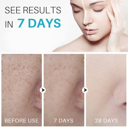 Dark Spot Corrector Remover