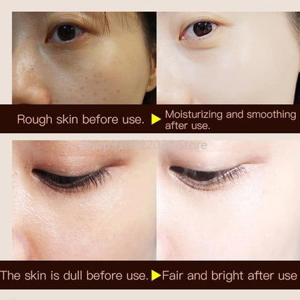 30g Woman Lady Face Whitening Cream For Dark Skin Spots Scars Snow