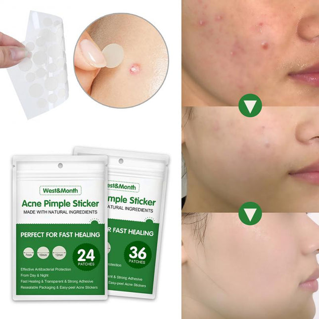 36pcs Acne Pimple Patch Invisible Waterproof Absorb Pus Acne Treatment
