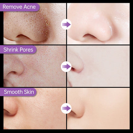 Auquest Blackhead Remover Nose Face Mask Pore Deep Cleansing Shrink
