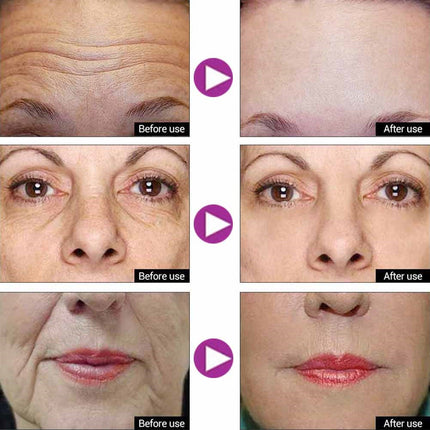 Anti-wrinkle Face Cream Serum Eye Cream Pro-xylane Anti Aging Set