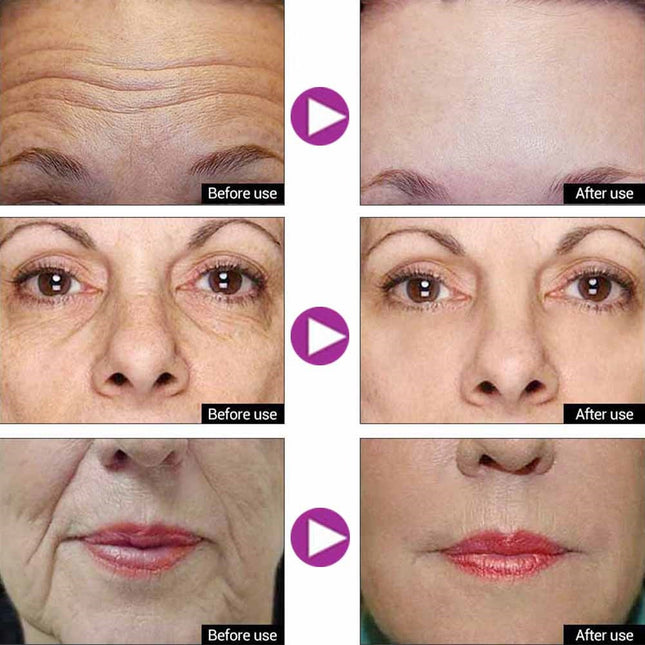 Anti-wrinkle Face Cream Serum Eye Cream Pro-xylane Anti Aging Set