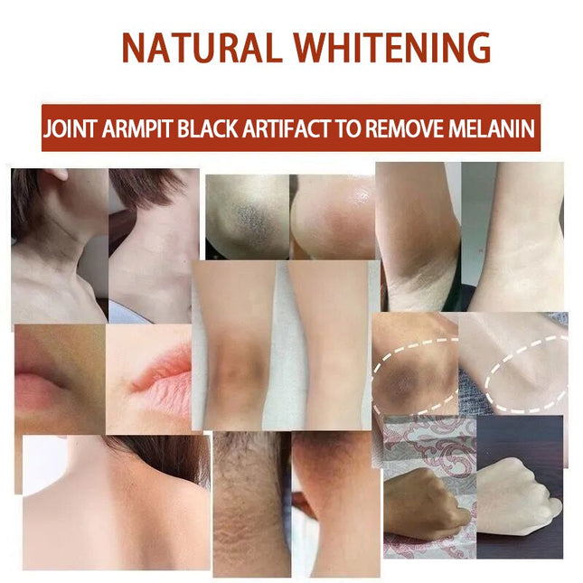 Body Whitening Soap Women Private Bleach Product Rapid Brighten Repair
