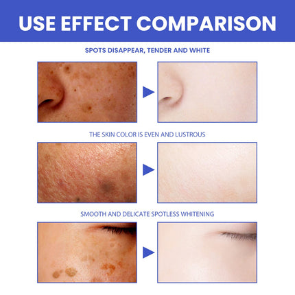 Nicotinamide Whitening Facial Cleanser Foam Face Wash Remove Melasma