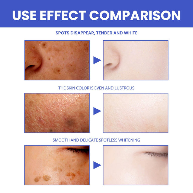 Nicotinamide Whitening Facial Cleanser Foam Face Wash Remove Melasma