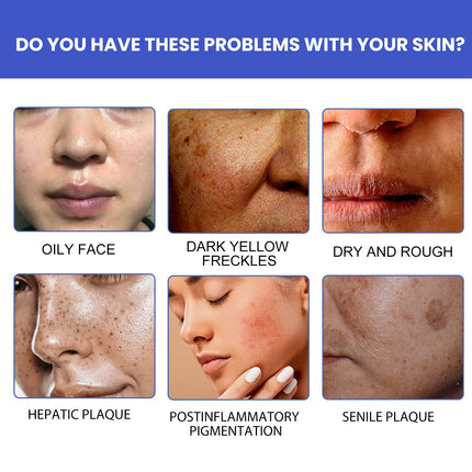 Nicotinamide Whitening Facial Cleanser Foam Face Wash Remove Melasma