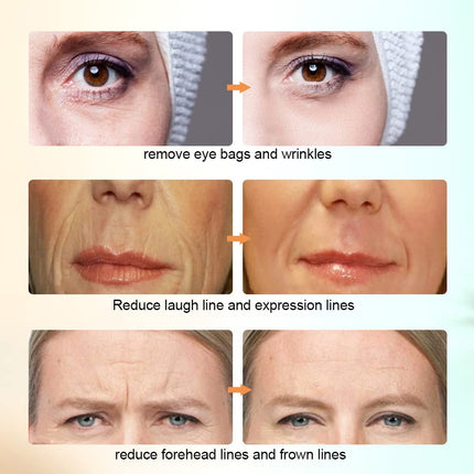 Rf Face Skin Tightening Electric Radio Frequency Massager Led Facial