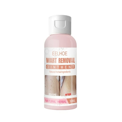 Skin Tag Remover Against Mole & Genital Wart Fast RemovWithin Al Anti