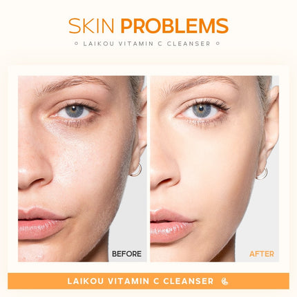 Vitamin C Facial Cleanser Whitening Moisturizing Brightening Deep